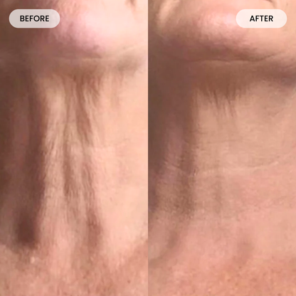 Fybelle Radiance Pro LED Neck & Décolletage Mask